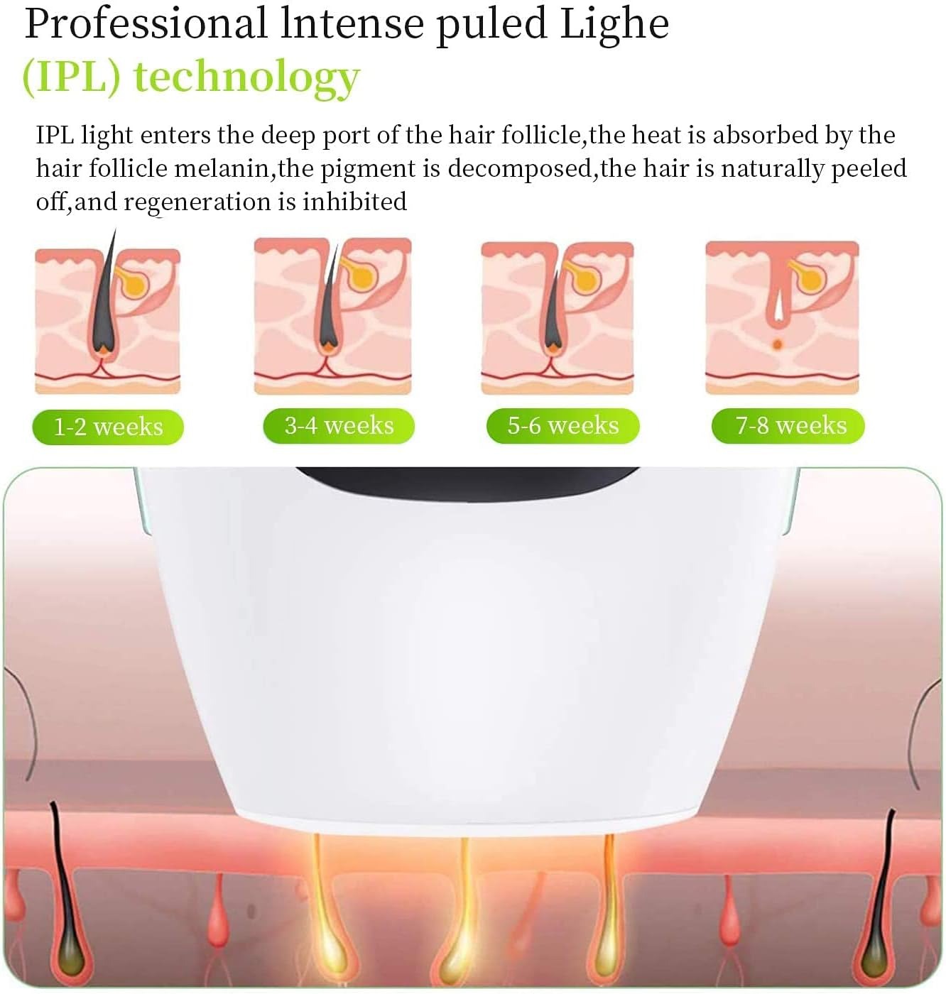 IPL Hair Removal System